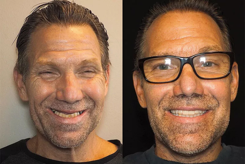 Before After Image