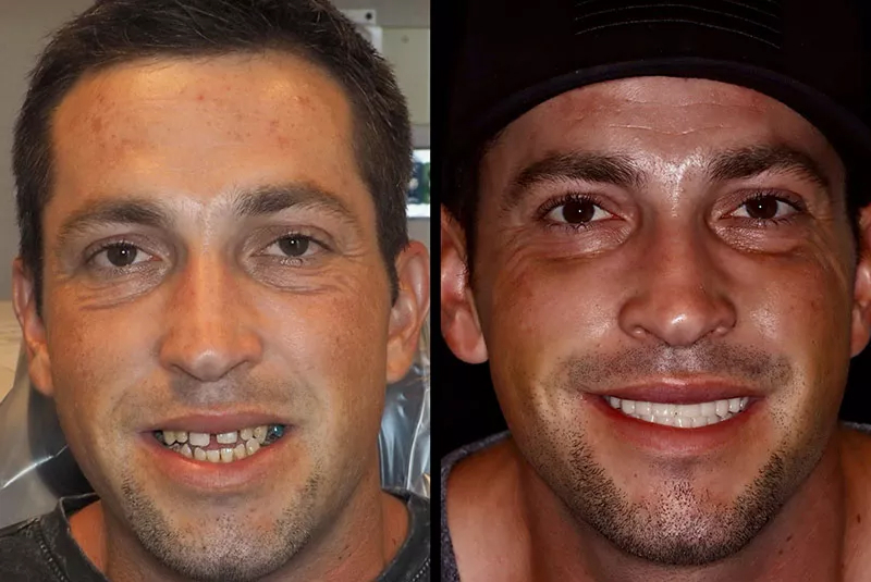 Before After Image